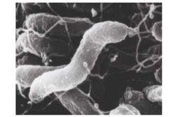 胃の表層を覆う粘液の中にすみつくというピロリ菌