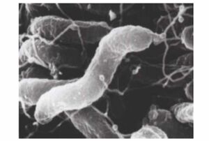 胃の表層を覆う粘液の中にすみつくというピロリ菌