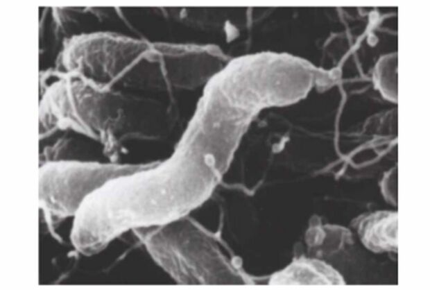 胃の表層を覆う粘液の中にすみつくというピロリ菌