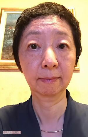 抗がん剤治療後、髪の毛が生えてきてウィッグをやめたころの唐澤先生