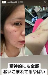 坂口杏里がインスタグラムに投稿したストーリー