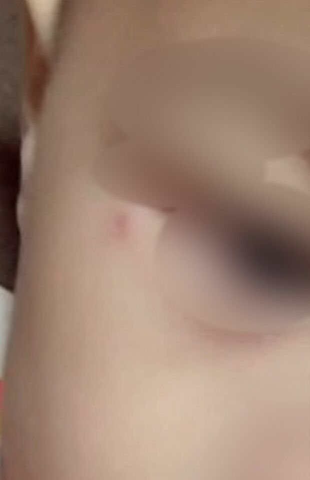 長男の顔のアップ写真。目の端に傷跡のようなはれがある（藍容疑者のツイッターより）