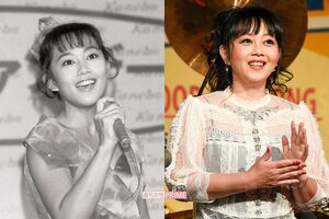 浅香唯（左は32年前）