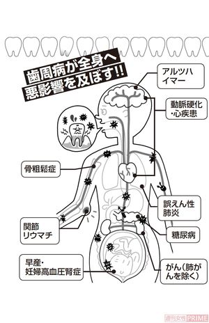 インプラント治療で高額請求 ブラック歯科 にカモられないためのポイント ニュース概要 週刊女性prime