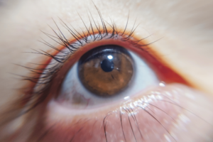 身体と心の不調を引き起こす「目の日焼け」対策