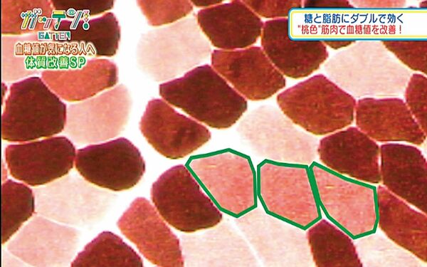 濃い色の筋肉細胞が「赤筋」、薄い色の細胞が「白筋」、その中間の（緑色の線で囲った）細胞が「ピンク筋」。写真提供／北海道大学大学院教育学研究院教授・水野眞佐夫さん