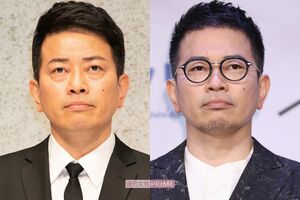 整形前(右)と、目の下のクマ除去をした宮迫博之