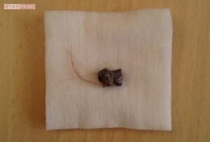 摘出された長さ約8ミリの鉛弾