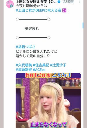 ヒアルロン酸注入について話す益若つばさ（『上田と女が吠える夜』の公式Xより）