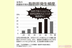 【年齢別】女性の脂肪肝発生頻度