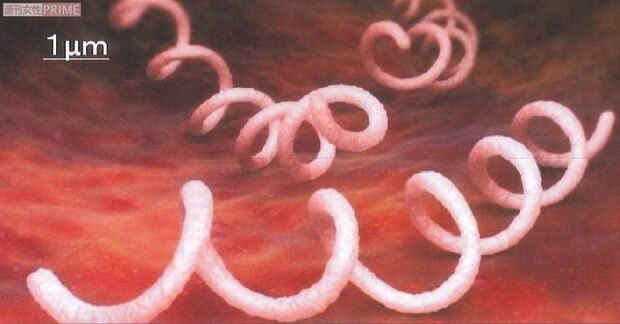 らせん状が特徴のトレポネーマ菌