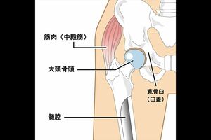 股関節の構造イメージ