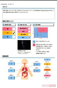 尿 唾液 血液 体液 1滴で判明 医師も絶賛する最新 がんリスク検査 の全貌 週刊女性prime