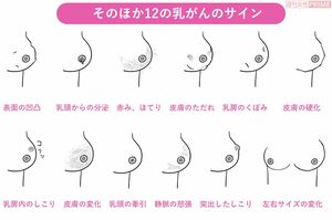 そのほか12の乳がんのサイン　イラスト／スヤマミヅホ