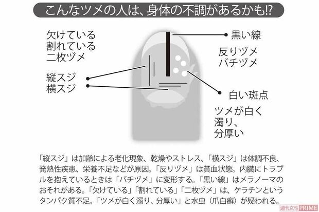 こんなツメの人は、身体の不調があるかも!?