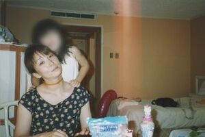  皮膚科医として開業しても、肌荒れに悩んでいた30代のころ