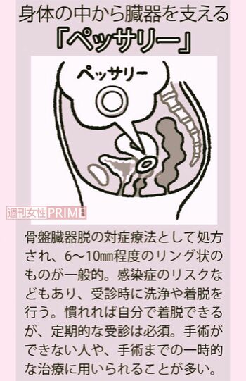 イラスト/やまだやすこ