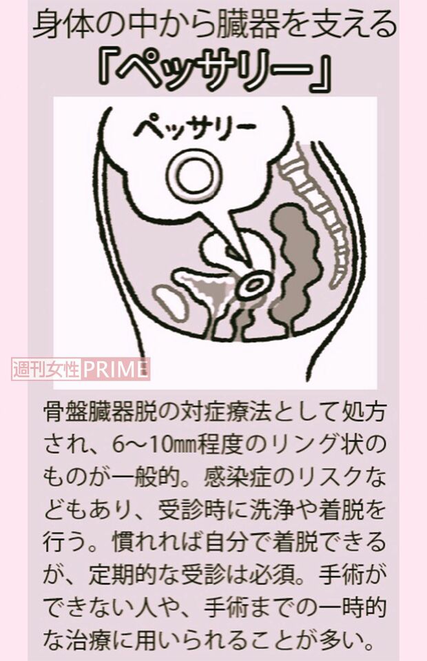 イラスト／やまだやすこ