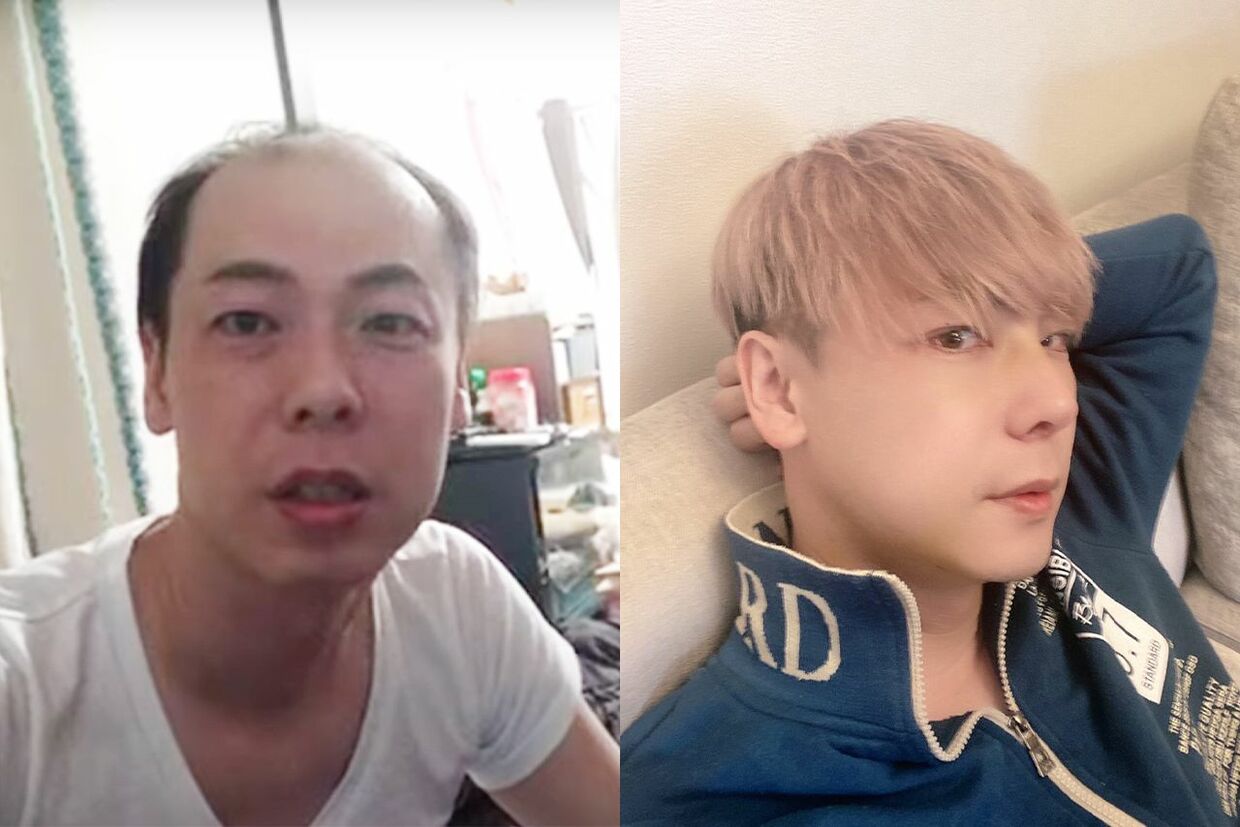 元『令和の虎』社長と“鑑定士youtuber”社長が暴露！「社長界隈の整形事情」と自身の整形トータル額を赤裸々告白「苦労なく女の子が寄ってくる 