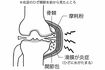 ひざ痛が起きるメカニズム