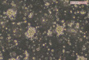 培養初日の免疫細胞の様子。単球（白血球の一種）を樹状細胞に培養