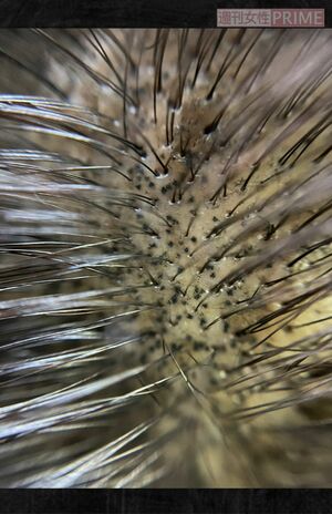 マイクロスコープの画像。毛髪の周りに小さな点を描いてある。離れると、立体感が出てまるで髪が生えているように!