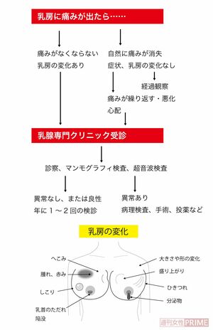 乳房に痛みが出た時の流れ