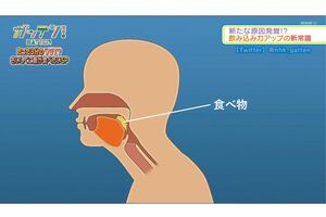 前かがみの姿勢だと舌圧が低下し、食べ物（黄色）が飲み込みにくくなる