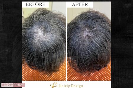 ヘアルプデザイン提供写真