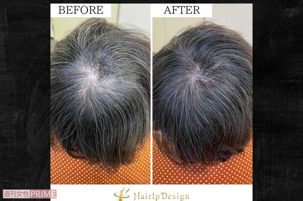 ヘアルプデザイン提供写真