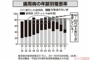 歯周病の年齢別罹患率