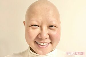 抗がん剤治療の副作用で脱毛。残った髪をそり、最後の抗がん剤を意味する“ラスケモ”から、髪が生えるまでも撮影。「つるつるになった頭は生きるために頑張った証しです」