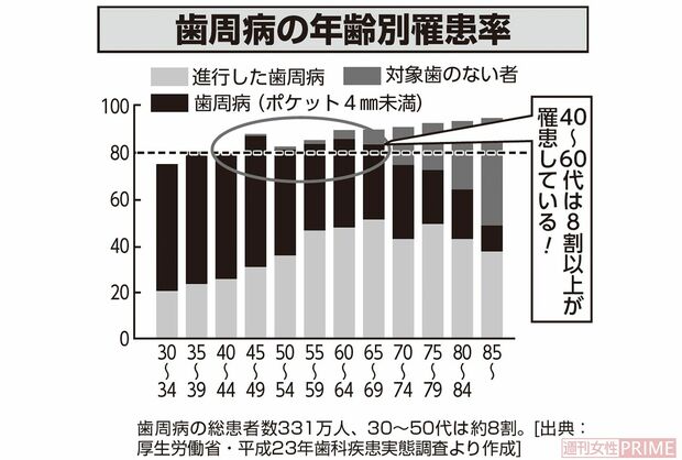 歯周病の年齢別罹患率