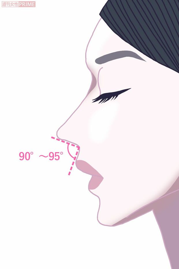 「鼻唇角（びしんかく）」は鼻の先端から付け根までの線と、鼻の付け根から上唇を結んだ線の交わる角度のこと。90度くらいが美しいとされる　イラスト／コバノン