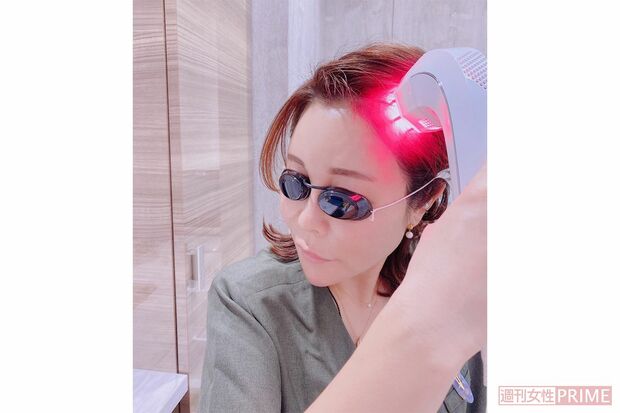 今泉先生が「レディッチトリプロ」を頭皮に使用している姿