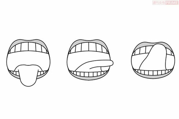 舌のトレーニング　イラスト／アライヨウコ