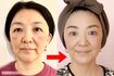 ちゃおさんのビフォー・アフター