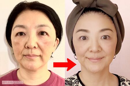 ちゃおさんのビフォー・アフター