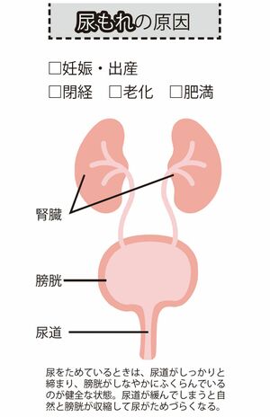 尿もれの原因