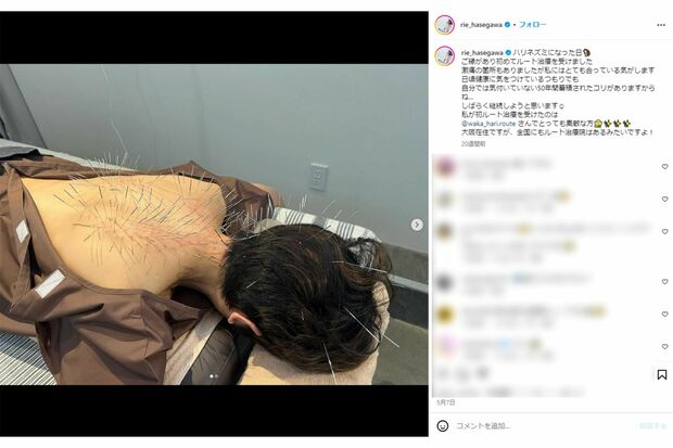 長谷川理恵は以前にもルート治療を受けていた(本人インスタグラムより)