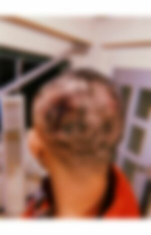 キャンドル氏から暴行を受けた直後の被害男性