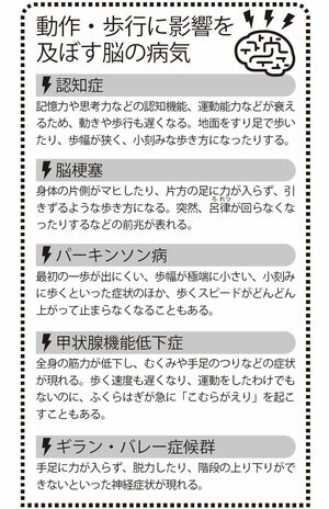 動作・歩行に影響を及ぼす脳の病気