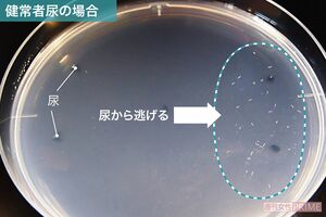 健常者尿の場合　がん