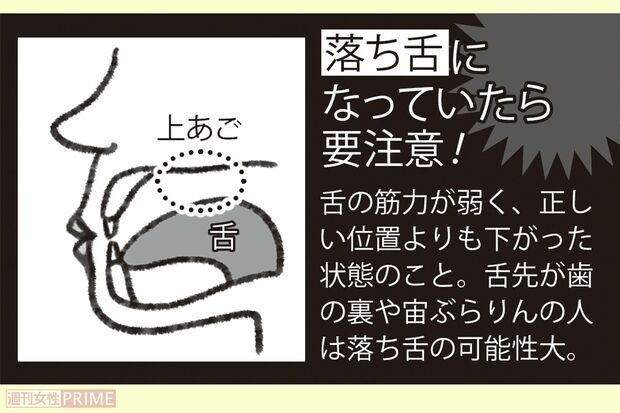 「落ち舌」になっていたら要注意！　イラスト／アサミナオ