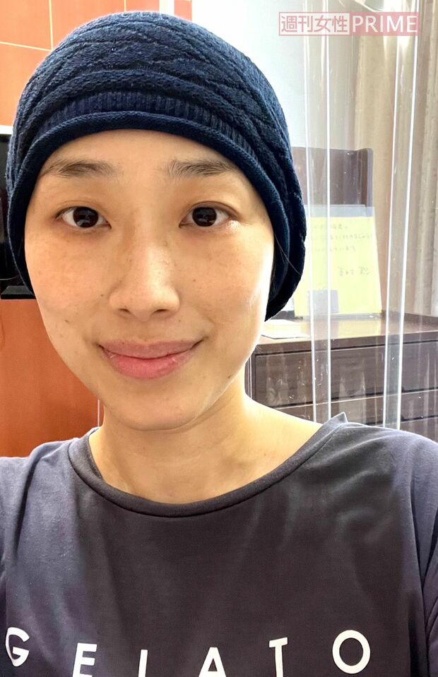 抗がん剤の副作用で脱毛し、わずかに残った毛も剃ってもらい一時はツルツル頭に。娘たちは「赤ちゃんみたいでかわいい」と言ってくれた