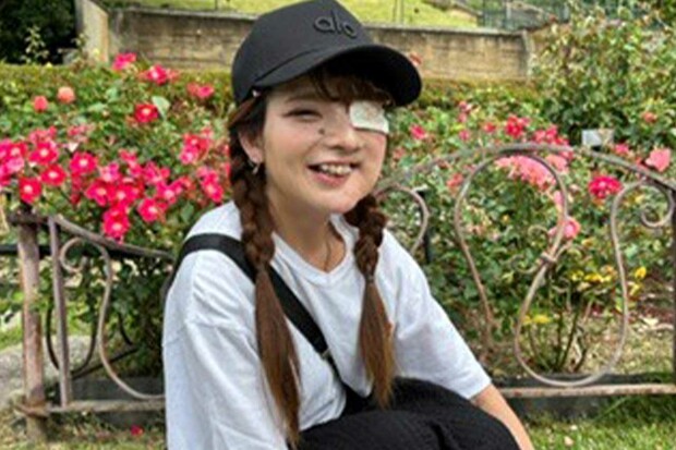 「武器、チャームポイント」と褒めたもらった眼帯をつけ過ごしているあやかさん