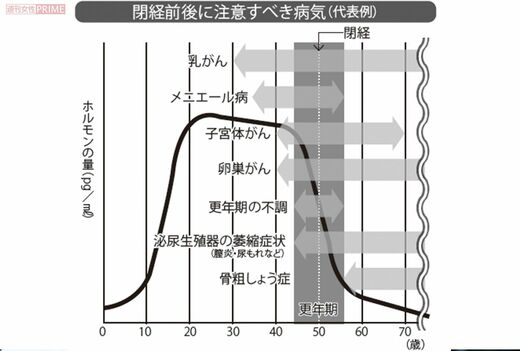 閉経後に注意すべき病気（代表例）