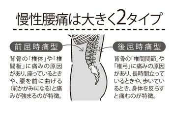 慢性腰痛の2つのタイプ