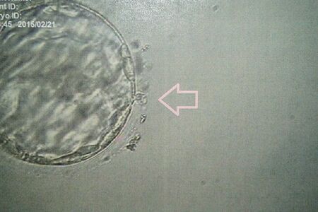 精子が卵子に入り込み生命が誕生する瞬間