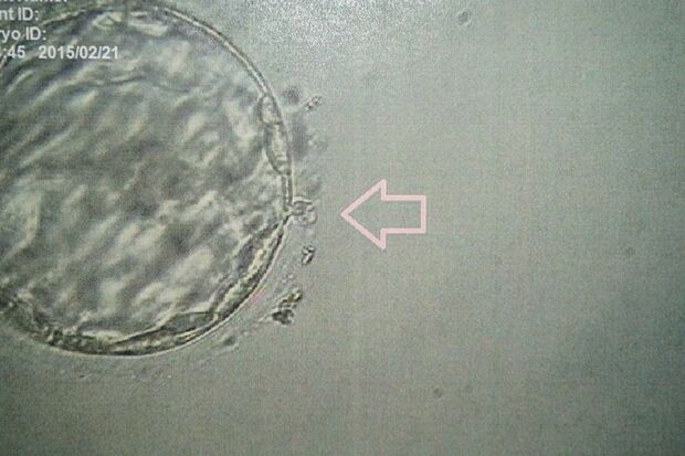 精子が卵子に入り込み生命が誕生する瞬間